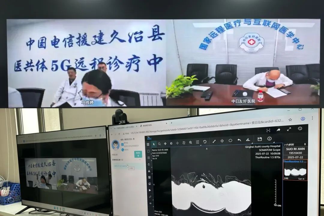གཅིག་སྒྲིལ་རྫོང་གིས5Gརྒྱང་རིང་དཔྱད་བཅོས་སྤྱད་དེ་ནད་པར་སྨན་བཅོས་བྱས་པ།
